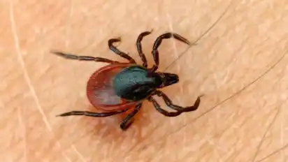 Lyme-Borreliose wird von Zecken übertragen.