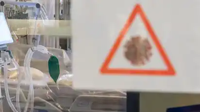 Die zusätzlichen Kosten durch die Pandemie – etwa für Intensivbetten in den Krankenhäusern – sollen in Teilen von den Versicherten gesetzlicher Kassen getragen werden.