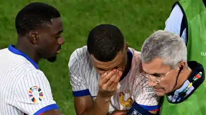 Mbappé (M) musste mit stark blutender Nase ausgewechselt werden.
